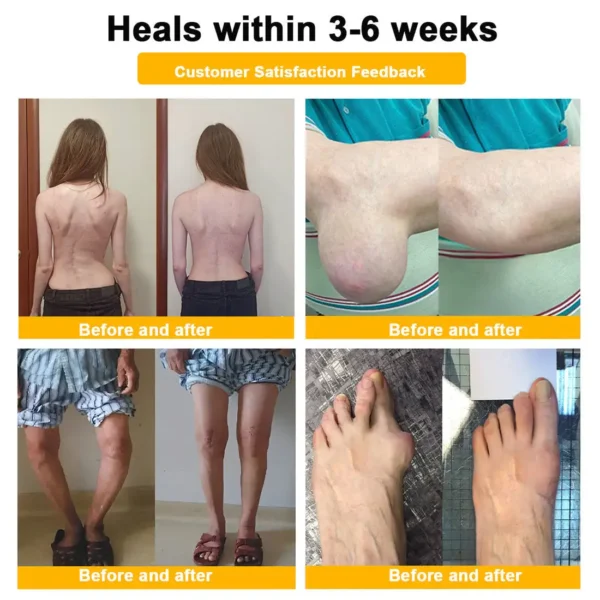 Daasry™ Botulinum Toxin & Bee Venom Pain-Relief Bone Healing Cream