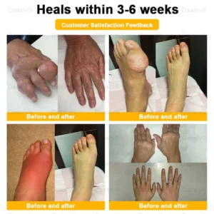 Daasry™ Botulinum Toxin & Bee Venom Pain-Relief Bone Healing Cream