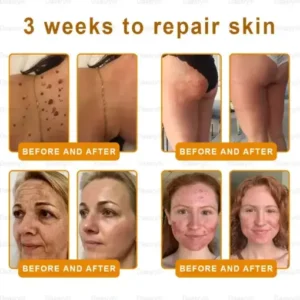 Daasry® Dermal Gold Botox Bee Venom Skin Restoration Cream