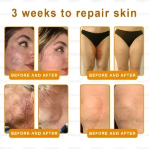 Daasry® Dermal Gold Botox Bee Venom Skin Restoration Cream