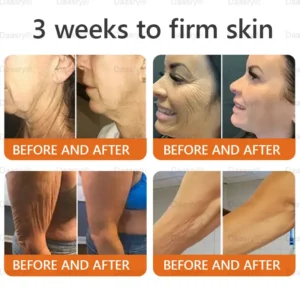 Daasry® Young Secret Botox Bee Venom Skin Restoration Cream