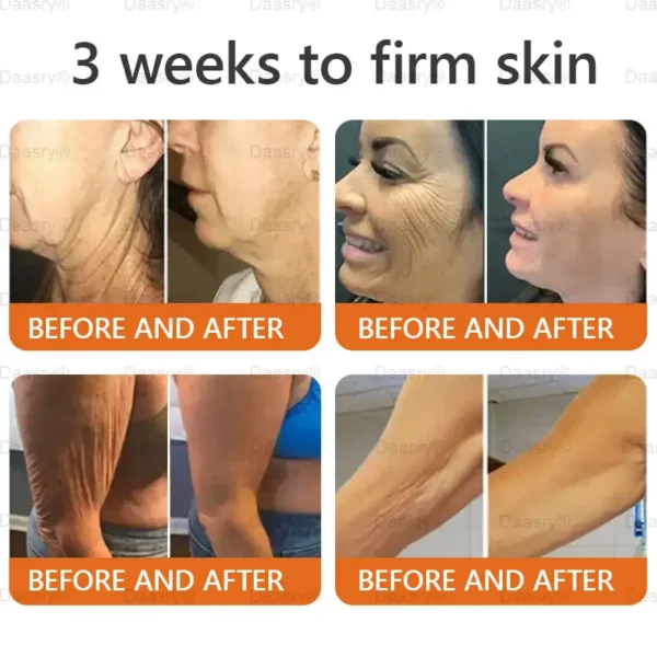 Daasry® Young Secret Botox Bee Venom Skin Restoration Cream