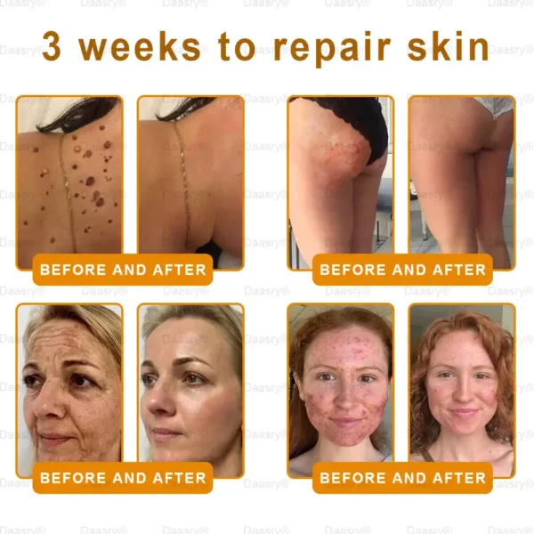 Daasry® Young Secret Botox Bee Venom Skin Restoration Cream