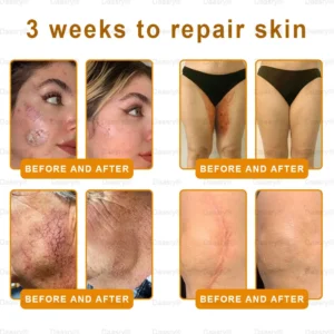 Daasry® Young Secret Botox Bee Venom Skin Restoration Cream