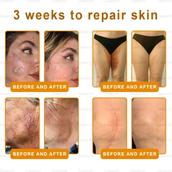 Daasry® Young Secret Botox Bee Venom Skin Restoration Cream