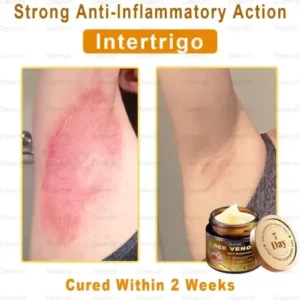 Daasry® All-in-One Skin Cream
