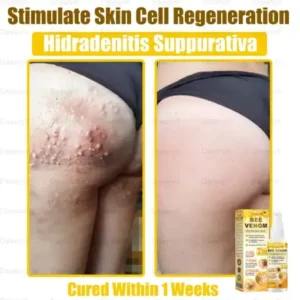 Daasry® Bee Venom Skin Restoration Spray