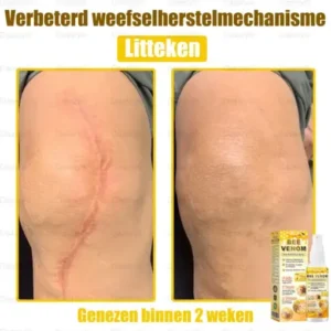 Daasry® Bee Venom Skin Restoration Spray
