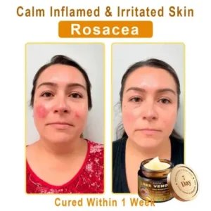 Daasry® Magnesium skin repair cream