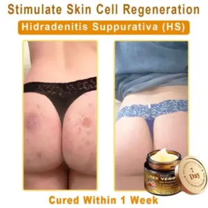 Daasry® Magnesium skin repair cream