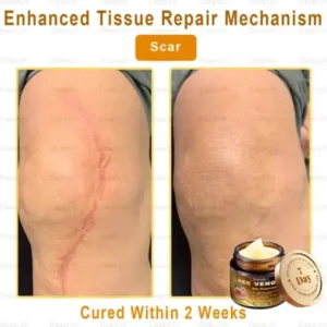 Daasry® Skin Repair Cream