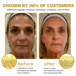 Daasry® Skin Treatment Cream