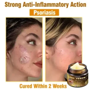 Daasry® Skin Treatment Cream