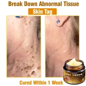 Daasry® Skin Treatment Cream
