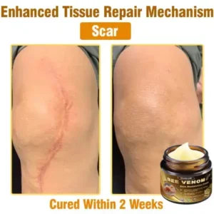 Daasry® Skin Treatment Cream