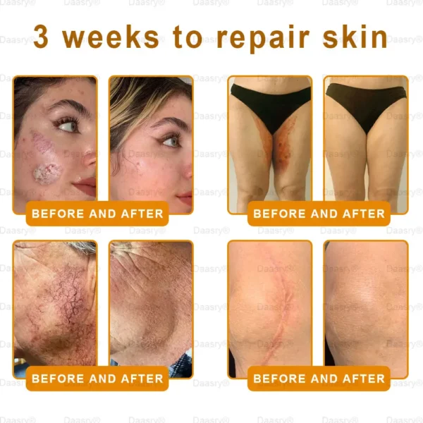 Daasry® Botox Bee Venom Skin Restoration Cream - Image 5