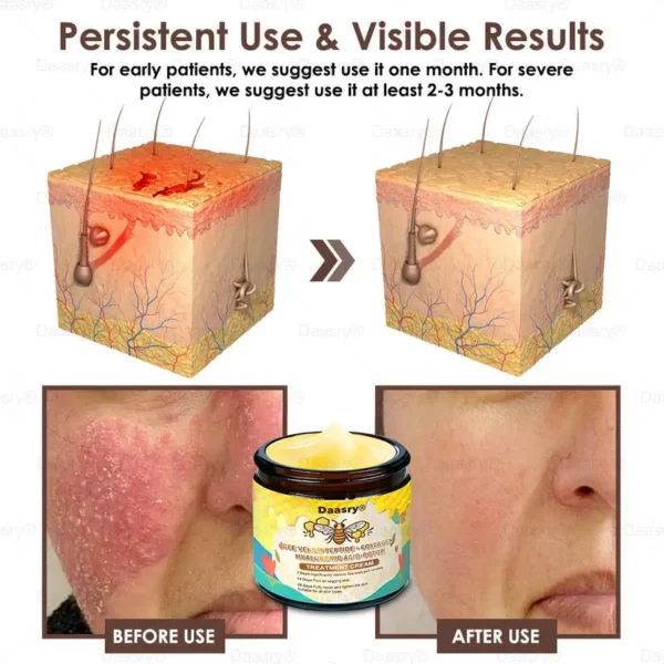 🇺🇸𝗚𝘂𝗮𝗿𝗮𝗻𝘁𝗲𝗲𝗱 𝗻𝗼 𝗿𝗲𝗰𝘂𝗿𝗿𝗲𝗻𝗰𝗲🌿𝐃𝐚𝐚𝐬𝐫𝐲® 𝐓𝐚𝐥𝐥𝐨𝐰 𝐁𝐞𝐞 𝐕𝐞𝐧𝐨𝐦 𝐒𝐤𝐢𝐧 𝐑𝐞𝐬𝐭𝐨𝐫𝐚𝐭𝐢𝐨𝐧 𝐂𝐫𝐞𝐚𝐦🇺🇸𝗠𝗮𝗱𝗲 𝗜𝗻 𝗨𝗦𝗔