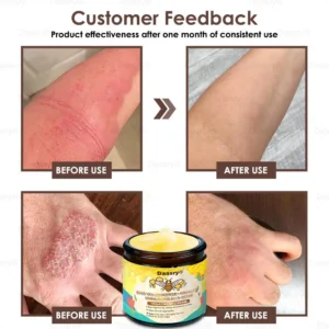 🇺🇸𝗚𝘂𝗮𝗿𝗮𝗻𝘁𝗲𝗲𝗱 𝗻𝗼 𝗿𝗲𝗰𝘂𝗿𝗿𝗲𝗻𝗰𝗲🌿𝐃𝐚𝐚𝐬𝐫𝐲® 𝐓𝐚𝐥𝐥𝐨𝐰 𝐁𝐞𝐞 𝐕𝐞𝐧𝐨𝐦 𝐒𝐤𝐢𝐧 𝐑𝐞𝐬𝐭𝐨𝐫𝐚𝐭𝐢𝐨𝐧 𝐂𝐫𝐞𝐚𝐦🇺🇸𝗠𝗮𝗱𝗲 𝗜𝗻 𝗨𝗦𝗔