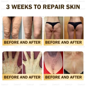 Daasry® Bee Venom Skin Repair & Anti-Aging Cream, Wrinkle Reduction, Hydrating, Brightening, Scar Healing, Sensitive Skin Relief, Even Tone