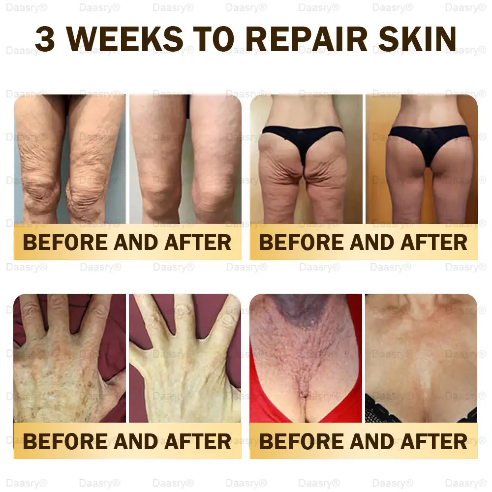 Daasry® Bee Venom Skin Repair & Anti-Aging Cream, Wrinkle Reduction, Hydrating, Brightening, Scar Healing, Sensitive Skin Relief, Even Tone