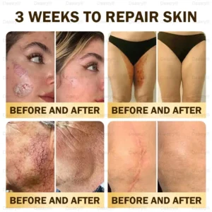 Daasry® Bee Venom Skin Repair & Anti-Aging Cream, Wrinkle Reduction, Hydrating, Brightening, Scar Healing, Sensitive Skin Relief, Even Tone