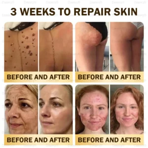 Daasry® Bee Venom Skin Repair & Anti-Aging Cream, Wrinkle Reduction, Hydrating, Brightening, Scar Healing, Sensitive Skin Relief, Even Tone