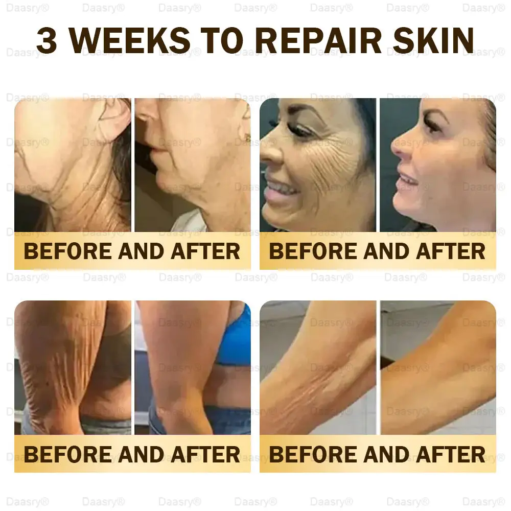 Daasry® Bee Venom Skin Repair & Anti-Aging Cream, Wrinkle Reduction, Hydrating, Brightening, Scar Healing, Sensitive Skin Relief, Even Tone