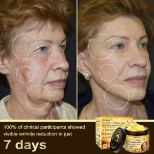 Daasry® Bee Venom Skin Repair & Anti-Aging Cream, Wrinkle Reduction, Hydrating, Brightening, Scar Healing, Sensitive Skin Relief, Even Tone