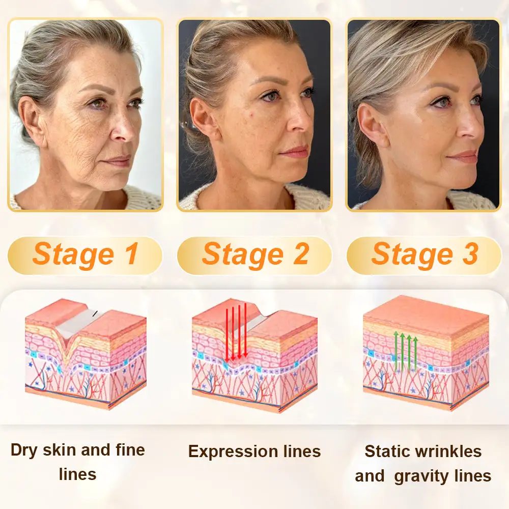 Daasry® Bee Venom Skin Repair & Anti-Aging Cream, Wrinkle Reduction, Hydrating, Brightening, Scar Healing, Sensitive Skin Relief, Even Tone