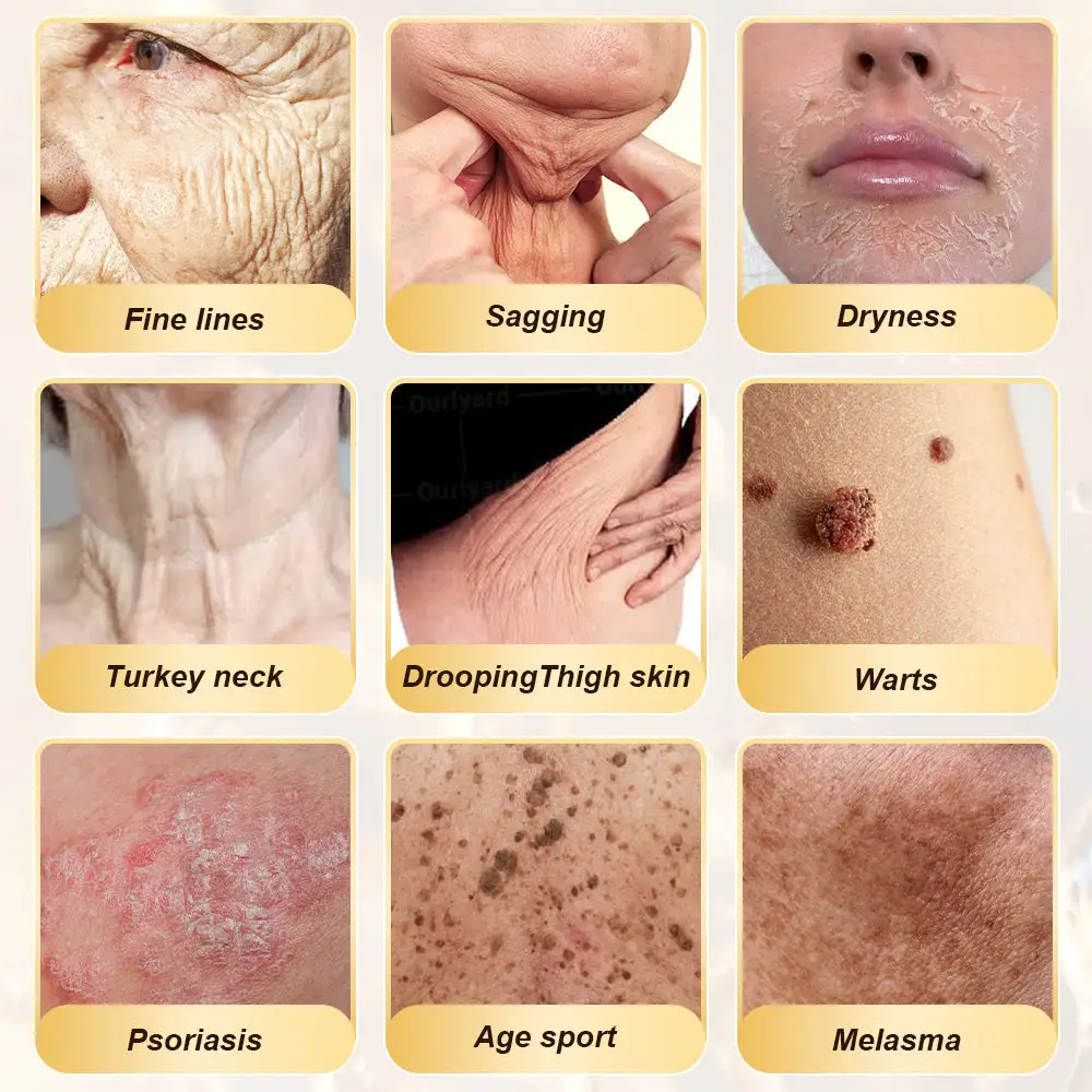 FDA Official: Daasry® Advanced Skin Repair & Anti-Aging Cream anti-aging, Wrinkle Reduction, Hydrating, Brightening, Scar Healing, Sensitive Skin Relief, Even Tone