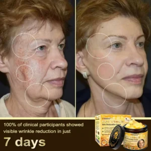 🎇𝓓𝓪𝓪𝓼𝓻𝔂® 𝑩𝒆𝒆 𝑽𝒆𝒏𝒐𝒎 𝑺𝒌𝒊𝒏 𝑹𝒆𝒑𝒂𝒊𝒓 & 𝑨𝒏𝒕𝒊-𝑨𝒈𝒊𝒏𝒈 𝑪𝒓𝒆𝒂𝒎, Wrinkle Reduction, Hydrating, Brightening, Scar Healing, Sensitive Skin Relief, Even Tone