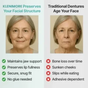 KLENIMORE™ Custom-Fit Fully Functional Dentures
